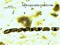 Jackrogersella multiformis-amf991-micro